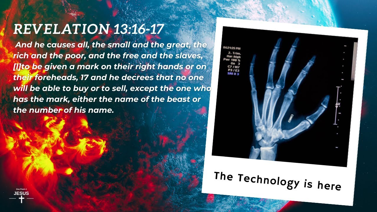 MARK OF THE BEAST-TECHNOLOGY IS HERE! END TIMES! REVELATION 13:16-17 #endtimes #markofthebeast