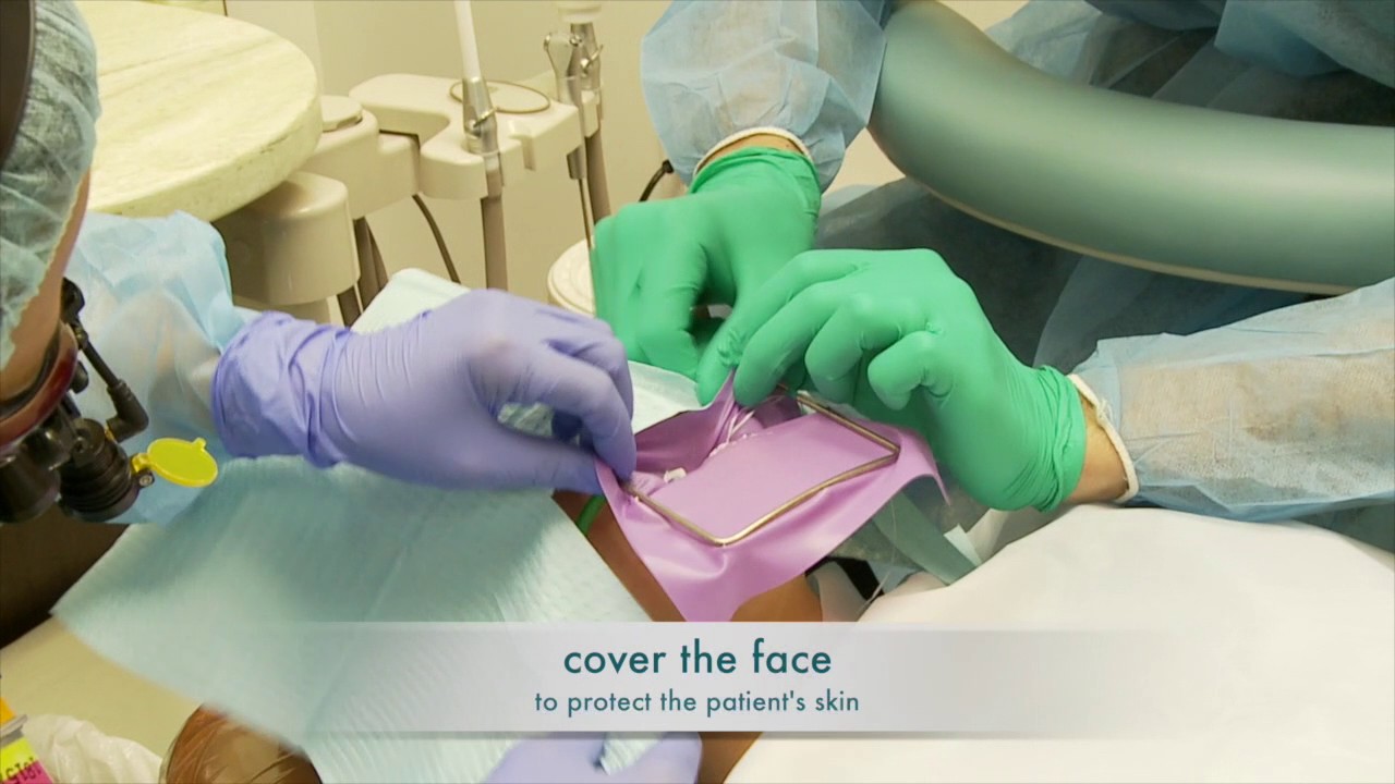 How to Safely Replace Silver Fillings