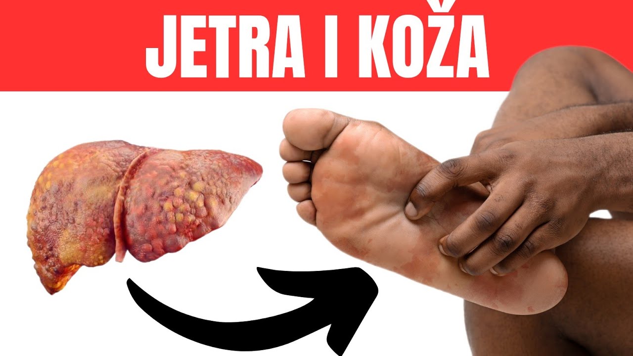 Что кожа говорит о жирной печени? Не стоит игнорировать эти знаки!