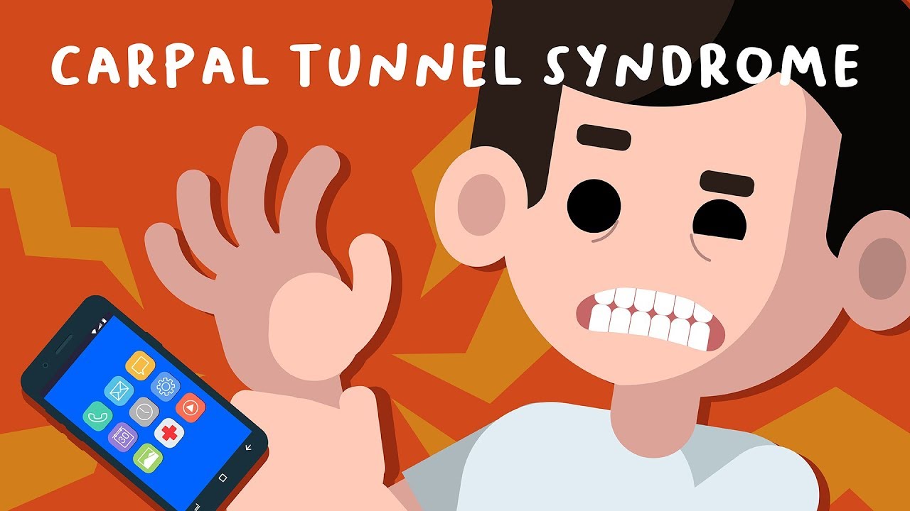Akibat Main Hp Terlalu Banyak - Carpal Tunnel Syndrome