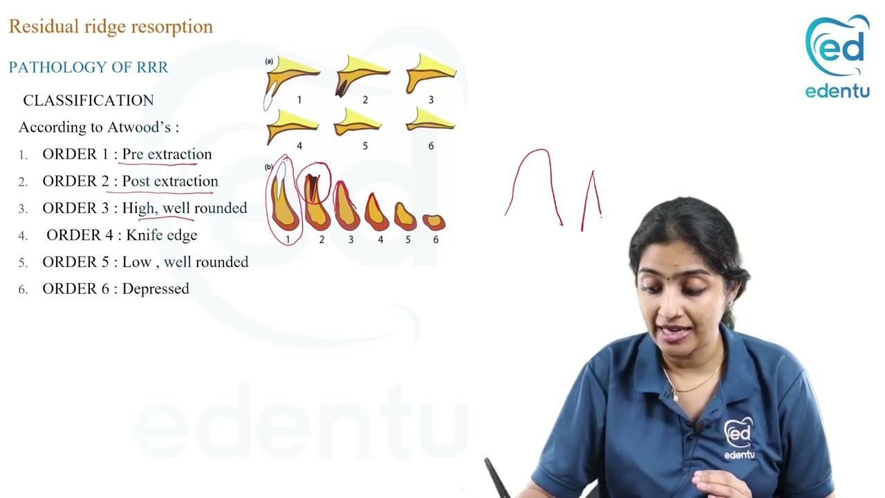 RESIDUAL RIDGE RESORPTION - Prosthodontics