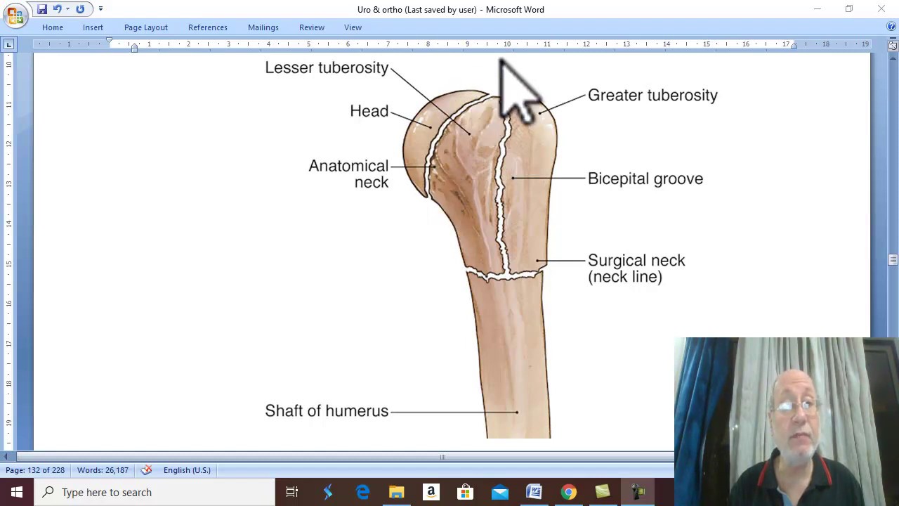 Orthopedic in Arabic 13 ( Fractures of proximal humerus ) . by  Dr. Wahdan