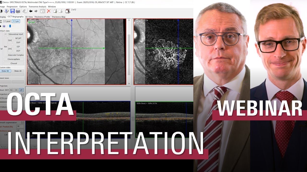 Systematic Interpretation of OCT Angiography Images | SPECTRALIS OCTA