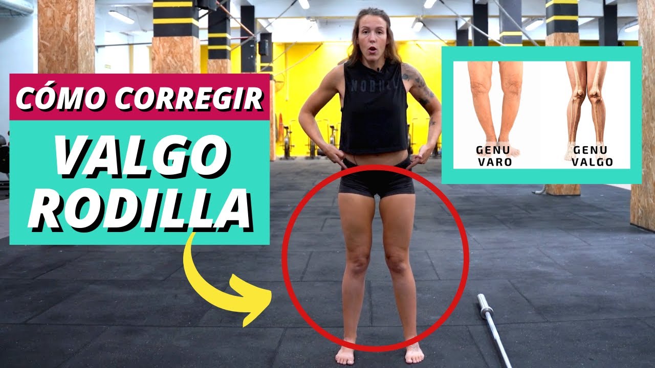 Mejora tu VALGO de RODILLA + Rehabilitación y Fortalecimiento para el DOLOR de Rodilla