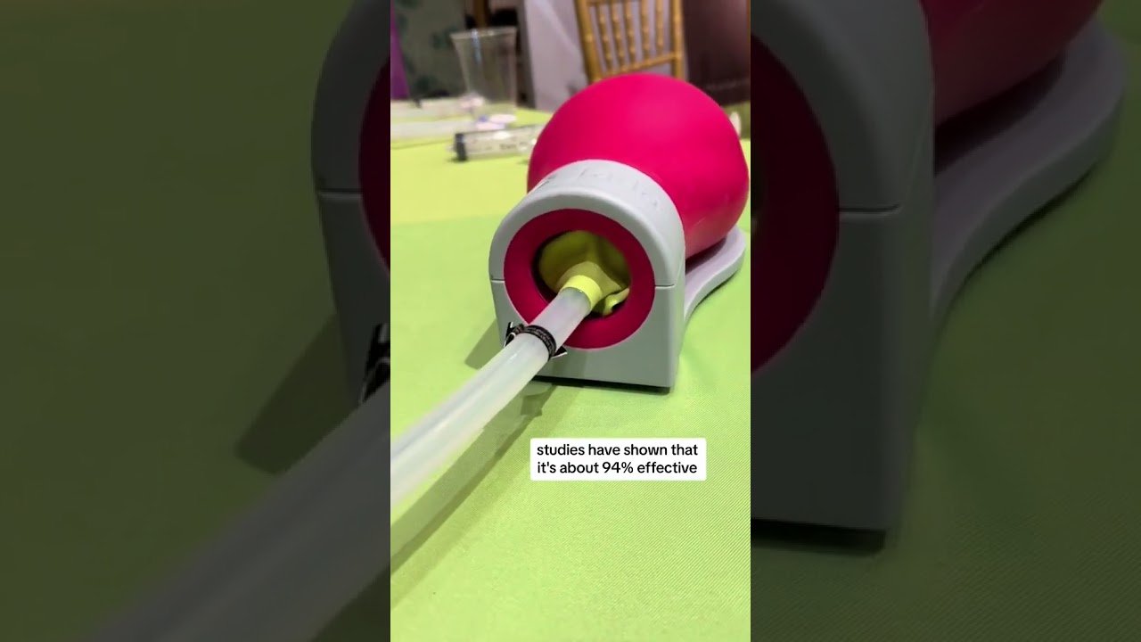 OBGYN simulation: Jada device that controls hemorrhage after #birth #doctor #medical #nurse