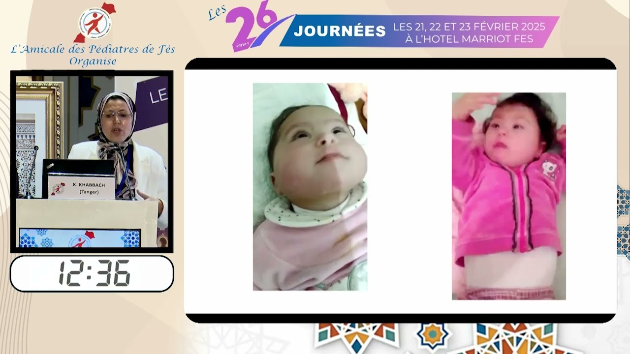 Les spasmes infantiles: K. Khabbach (Tanger)