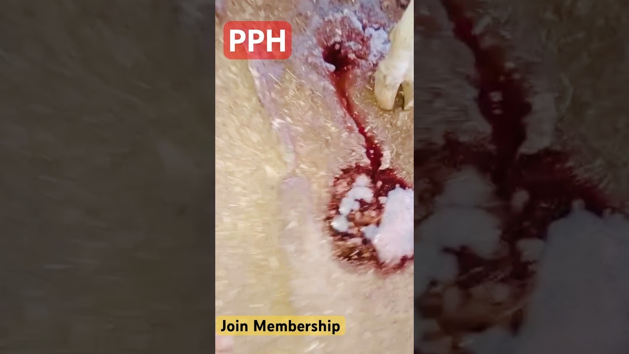 PPH (Redwater) : Diagnosis and Treatment Strategy?