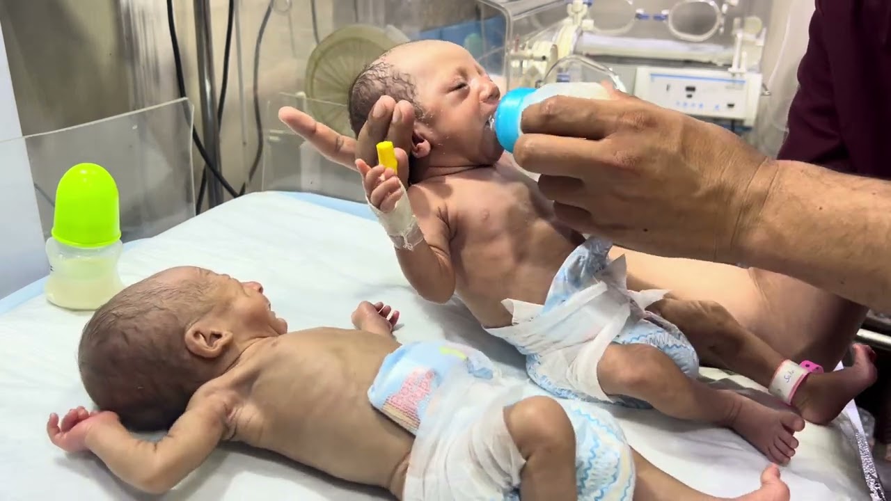Cute Baby Fully Covered & Stable in Our NICU | Recovery Journey 💕👶