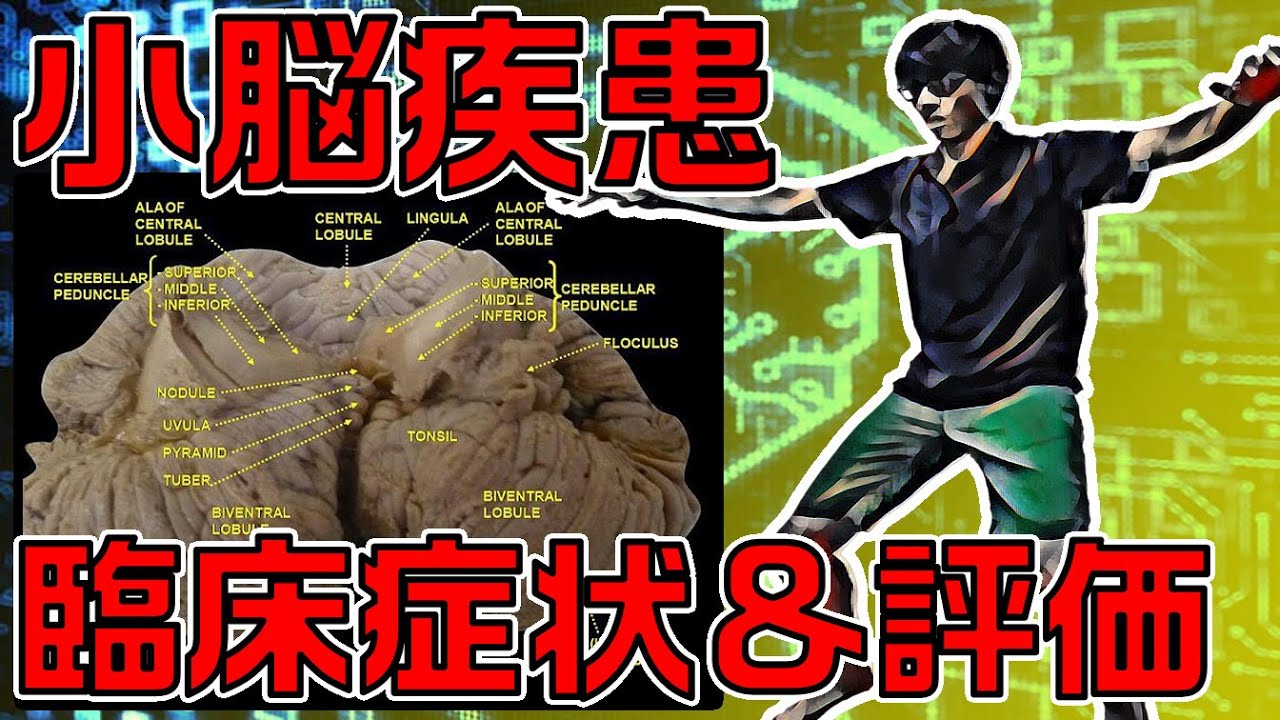 【小脳出血＆小脳梗塞】運動失調や認知機能低下など小脳疾患が抱える臨床症状＆評価のポイントを解説します！