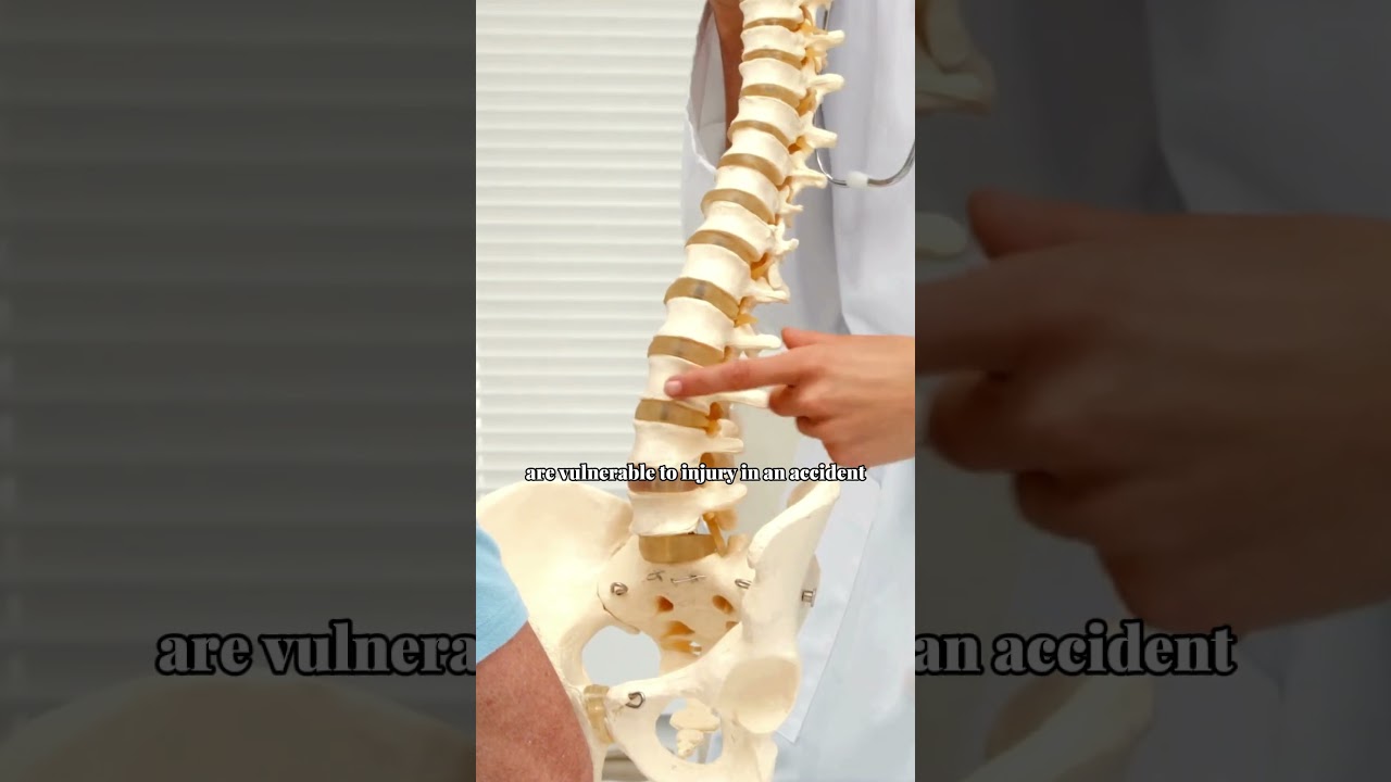 Lower Back Pain After a Car Accident? | Common Causes Explained