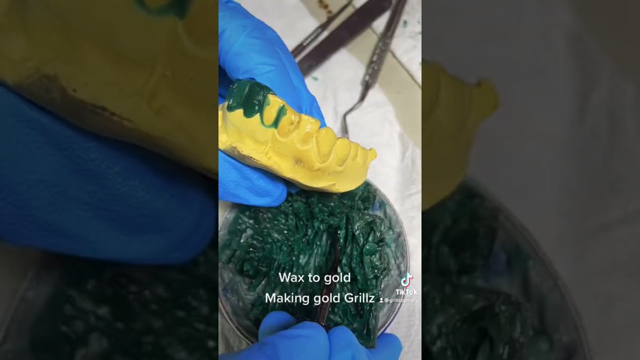 Making gold Grillz