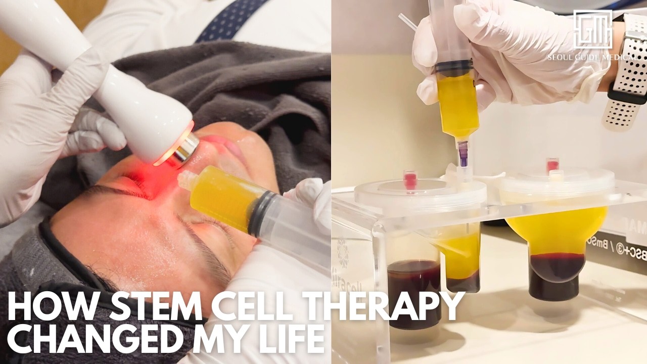What Is Stem Cell Therapy? Procedure, Benefits & Real Results | Anti-Aging & Healing