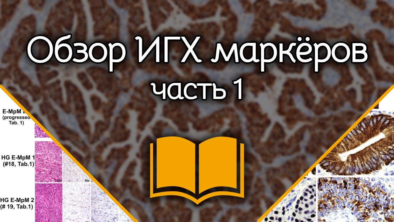 Общий обзор иммуногистохимических маркёров: Часть 1