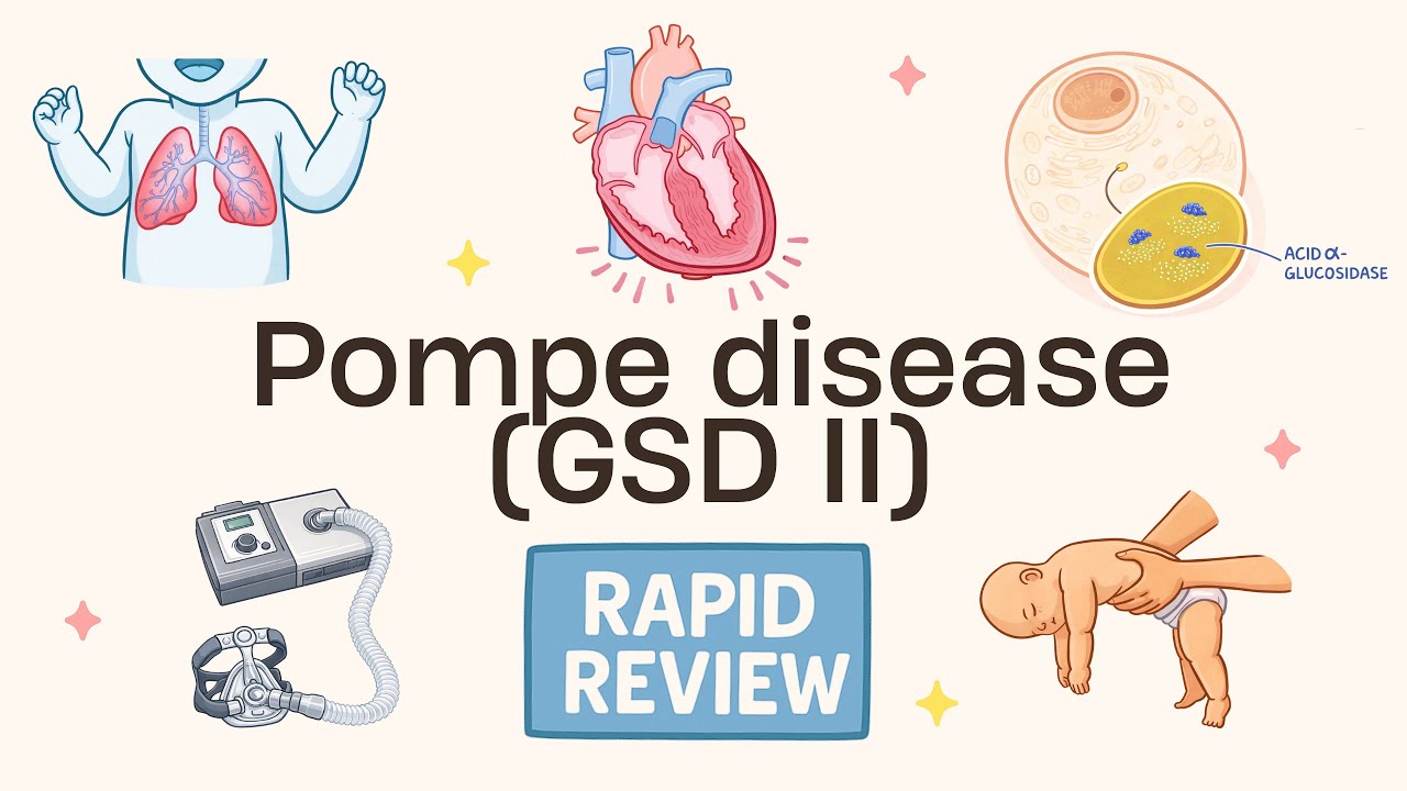Rapid Review (43/175): Pompe disease (GSD II)