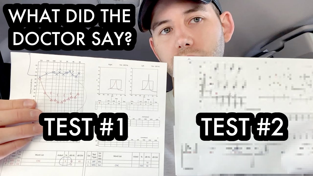 Sudden Hearing Loss - 2nd Hearing Test Results