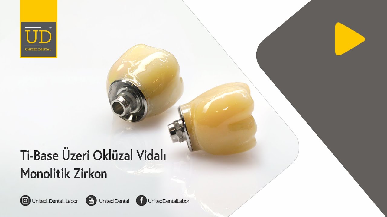 Ti-Base &Uuml;zeri Okl&uuml;zal Vidalı Monolitik Zirkonyum- United Dental - Tasarım, Ar-Ge ve &Uuml;retim Merkezi
