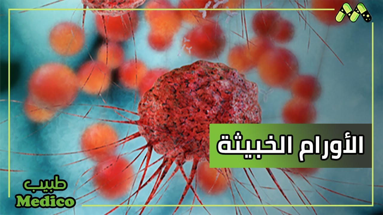 تعرف على أورام الرحم الخبيثة والمشيمة مع د. حسن صلاح