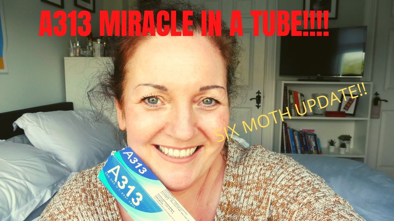 A313 MIRACLE IN A TUBE!! 6 MONTH UPDATE!!!