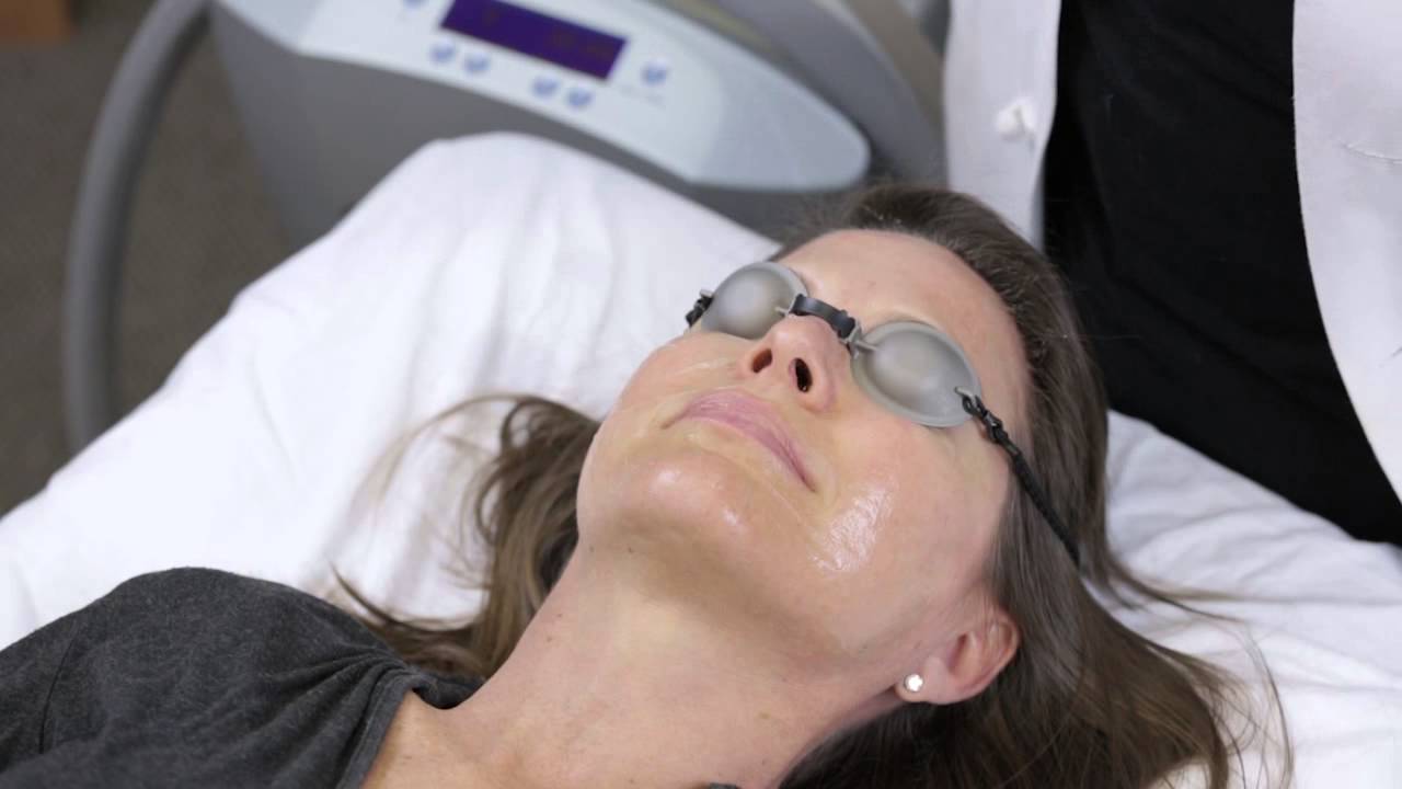 Quanta IPL Skin Treatment