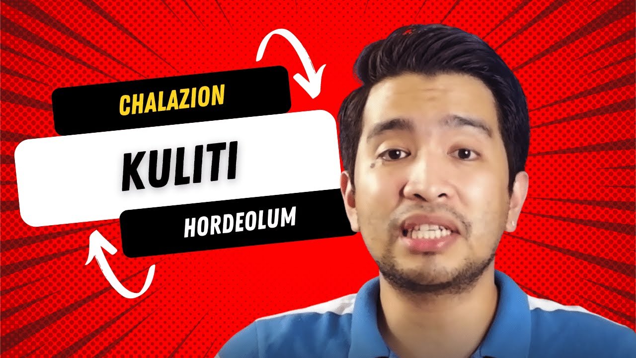 GAMOT SA KULITI (CHALAZION)
