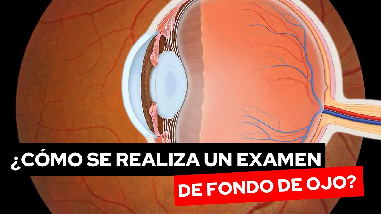Examen de fondo de ojo: &iquest; para qu&eacute; y c&oacute;mo se realiza ? 👁️💧