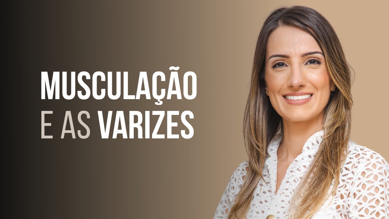 Quem tem varizes pode fazer muscula&ccedil;&atilde;o e academia?