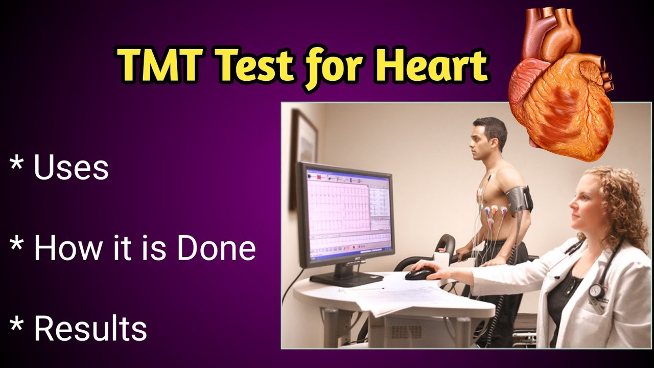 How TMT Test for Heart is done, Procedure and Cost