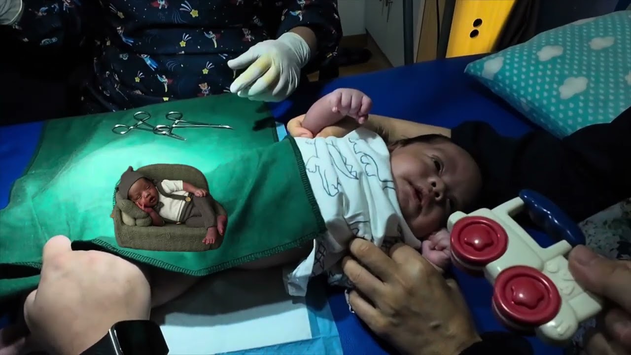 MasyaAllah, Anak Bujang Khitan (Sunat) di Umur 32 Hari. Alhamdulillah.