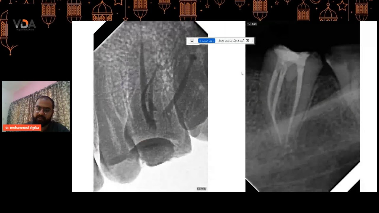 الدكتور القدير محمد الجرباءمحاضرة بعنوان Professional work with simple tools موتمر VDA الرمضاني