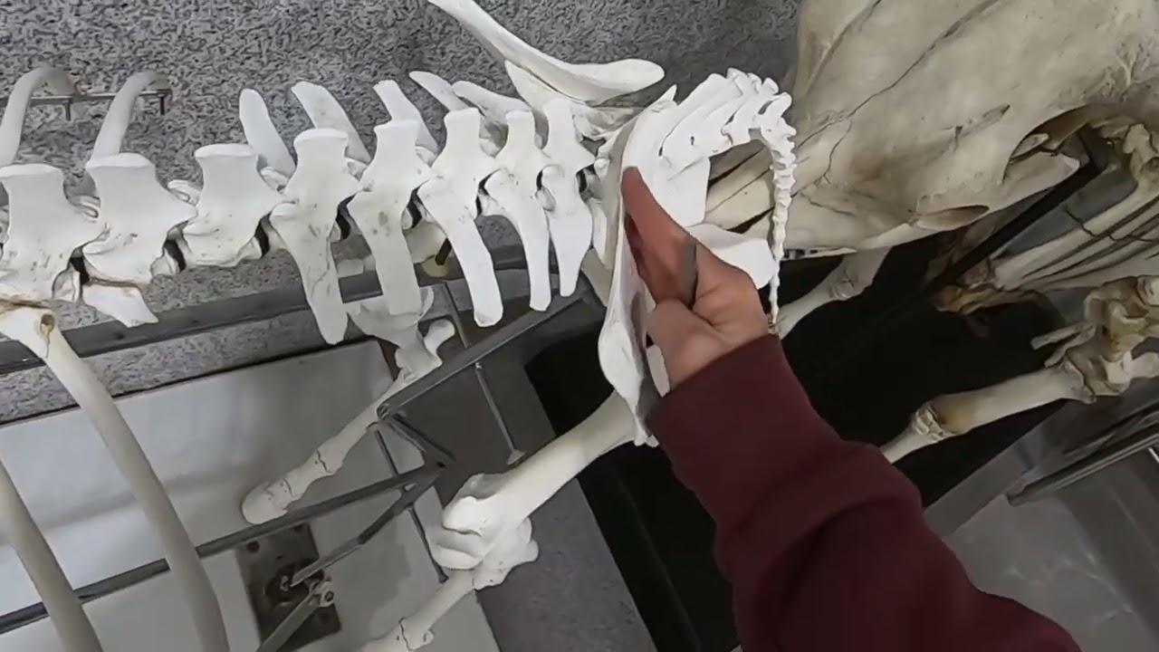LA Vertebrae