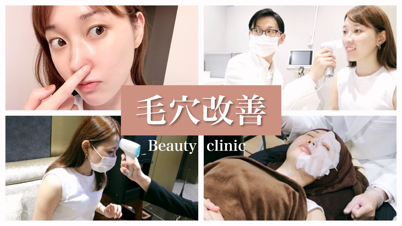 【毛穴・ニキビ改善】ダウンタイム無しのピコレーザーを打ってきた！
