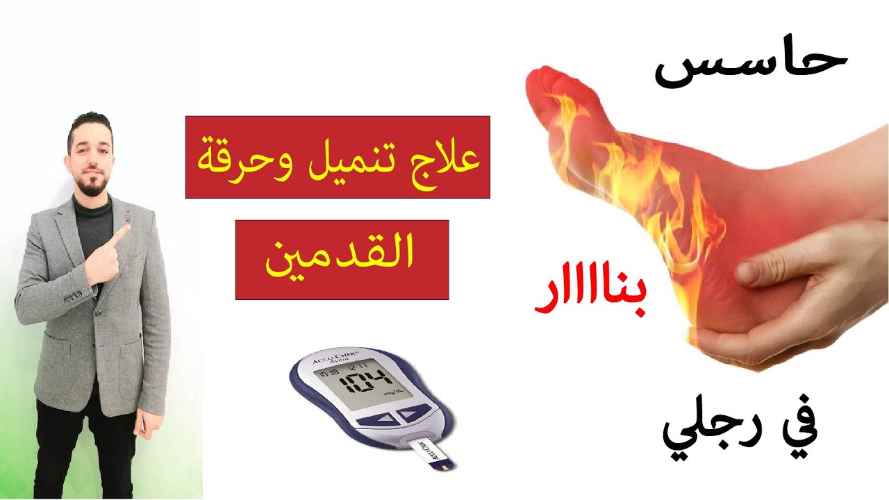 علاج حرقة وتنميل القدمين | أسباب التهاب الأعصاب الطرفية عند مرضى السكر