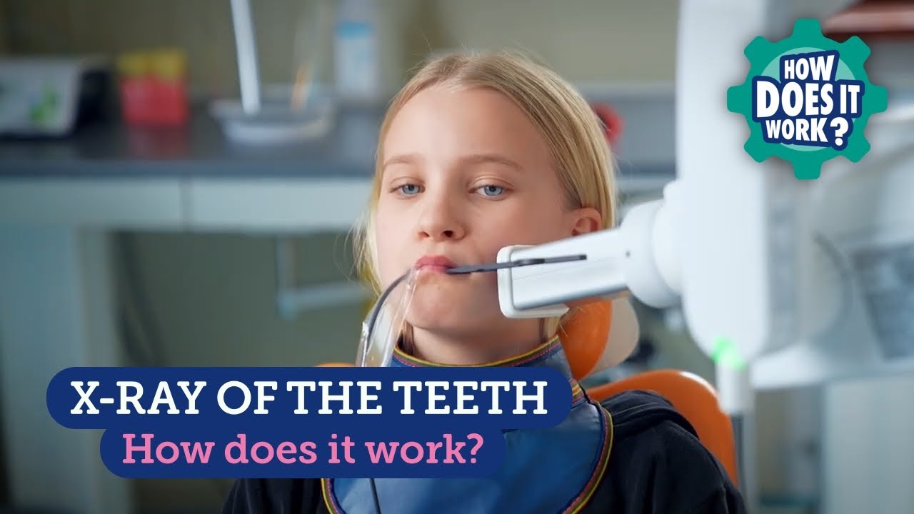 X-ray of the Teeth