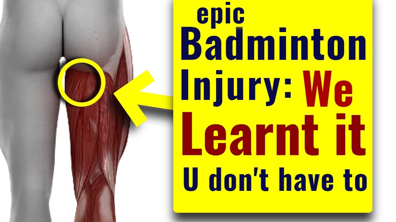 The Most Terrifying Badminton Injury: AVOID IT AT ALL COST!