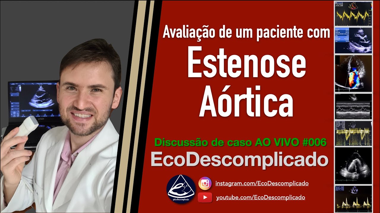 EcoDescomplicado - Discussão de caso AO VIVO #006 - Estenose Aórtica