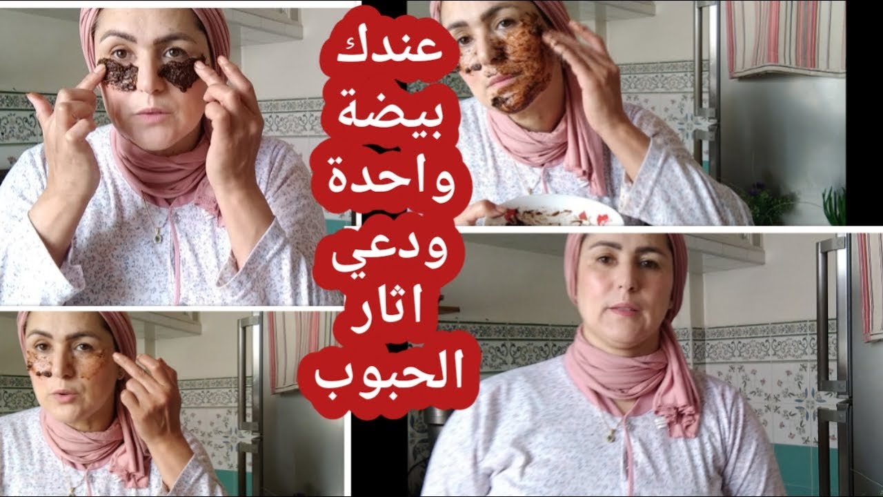 الكل يبحث على وصفة تخفي اثار الحبوب   وترجع الكولاجين للبشرة  وللهلات السوداء