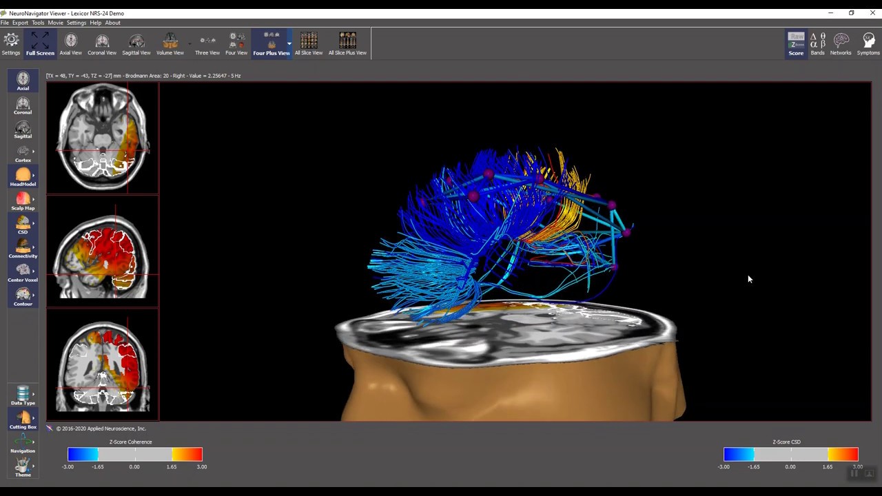 NeuroNavigator