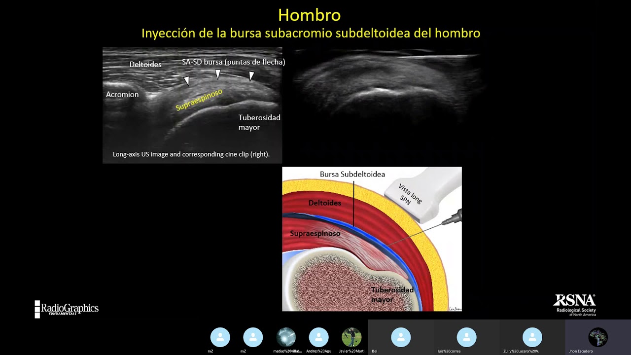 Procedimientos MSK guiados por Ultrasonido