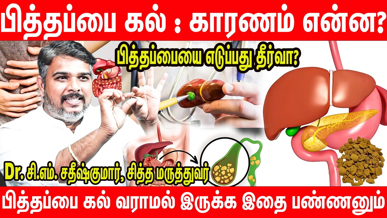 பித்தப்பை கல் : சித்த மருத்துவத்தால் தீர்வு | ஆதாரத்துடன் Dr. C.M. Sathish kumar Interview | Siddgha