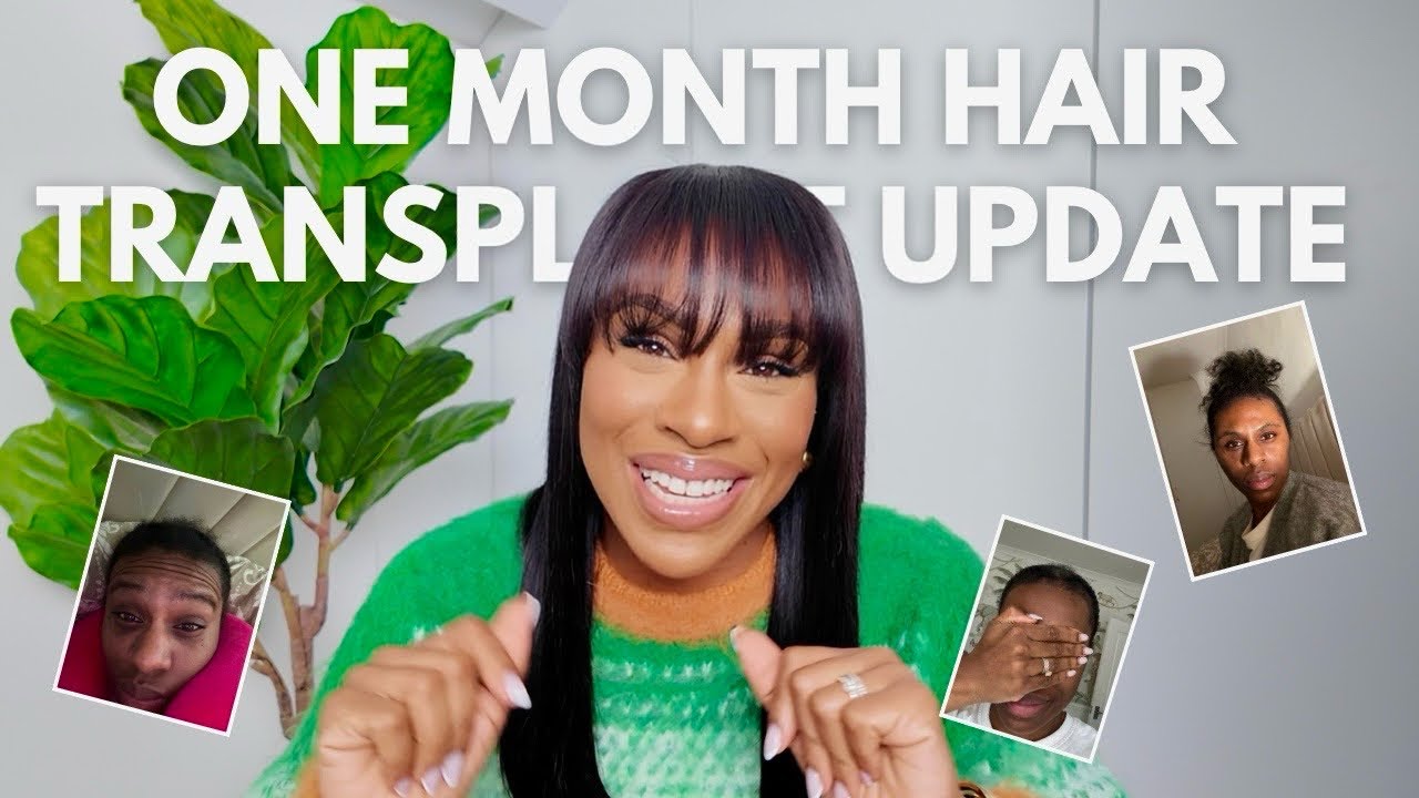 ONE MONTH HAIR TRANSPLANT UPDATE | AFRO HAIR