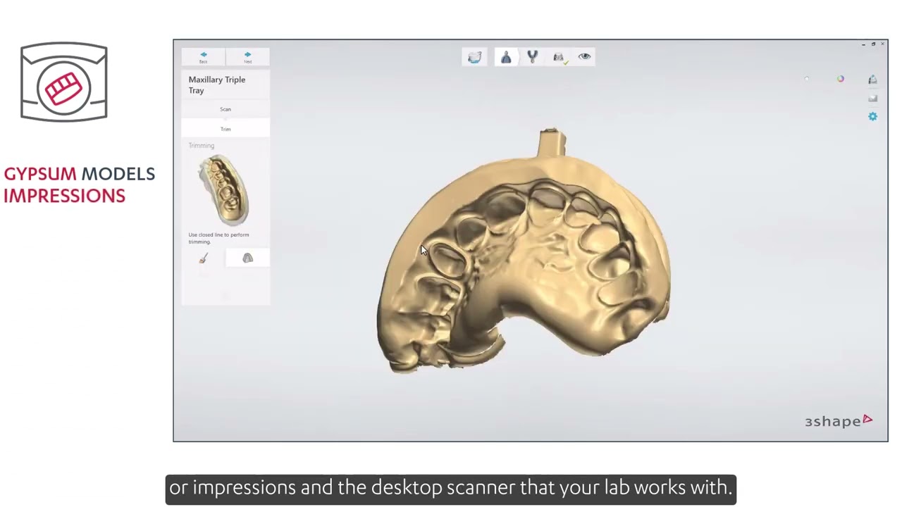Introduction to 3Shape Dental System