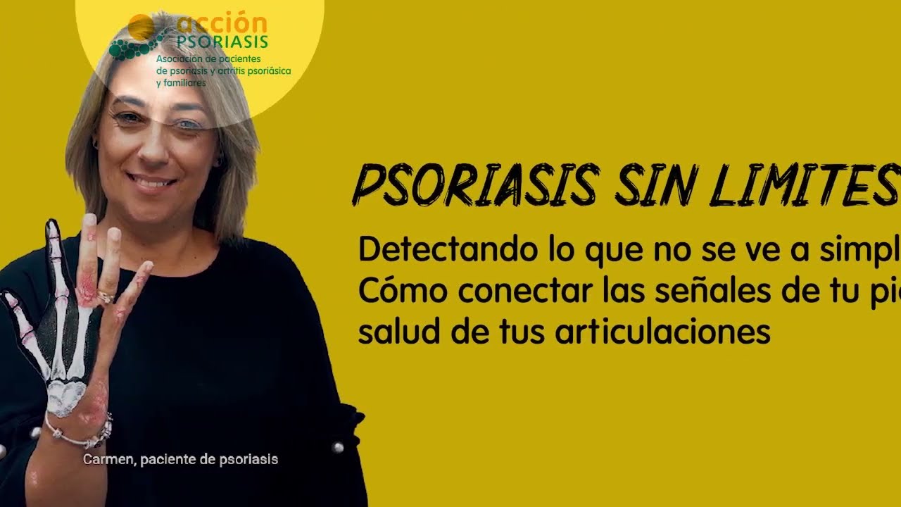 Artritis psoriásica: conecta las señales de tu piel con la salud de tus articulaciones.