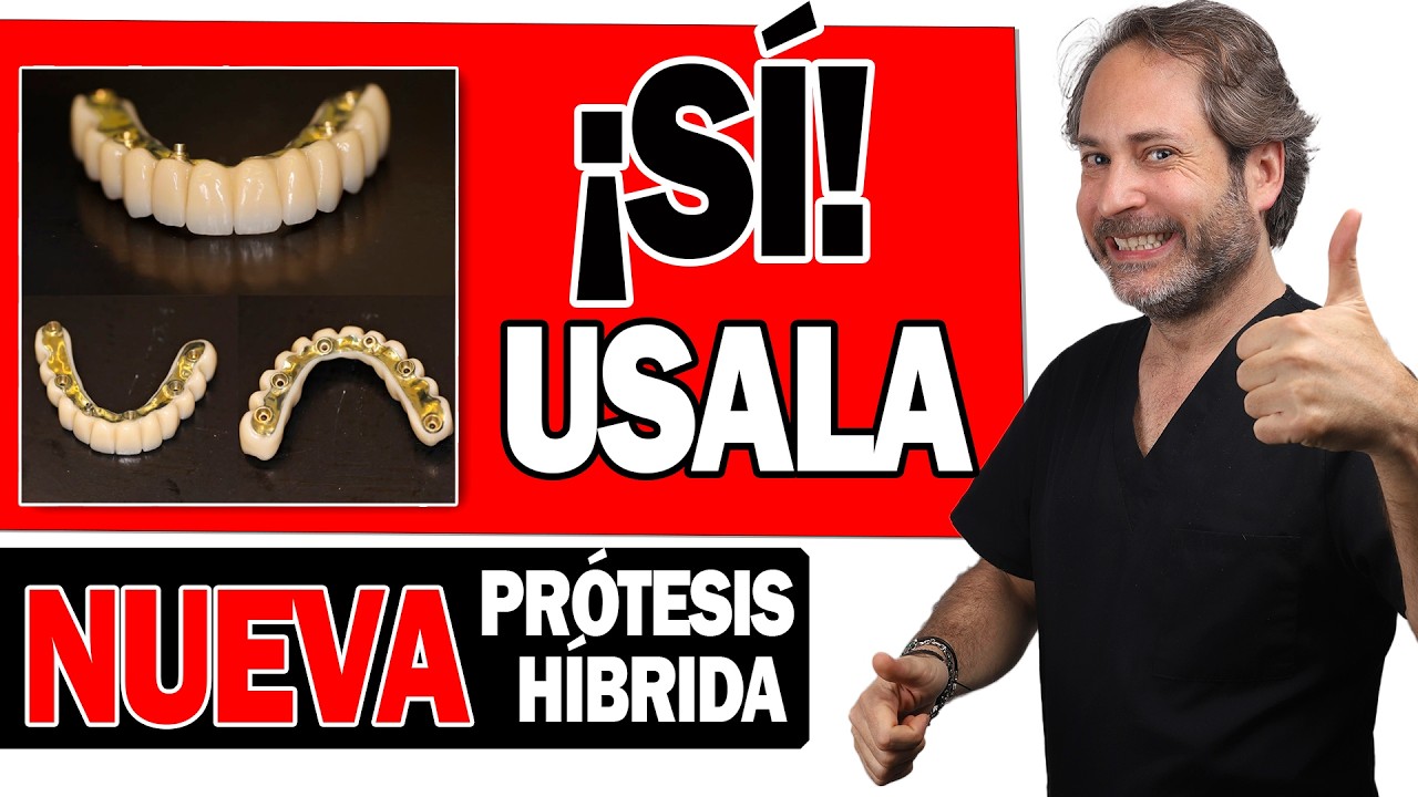 ✅NUEVA Pr&oacute;tesis 𝗛𝗜𝗕𝗥𝗜𝗗𝗔𝗦 𝘀𝗼𝗯𝗿𝗲 𝗜𝗠𝗣𝗟𝗔𝗡𝗧𝗘𝗦  Ventajas y Desventajas. Pr&oacute;tesis Dental Fija SI RECOMIENDO