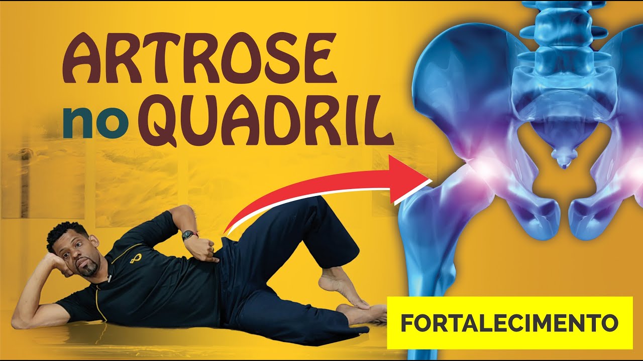 Exercícios fortalecimento p/ DOR NO QUADRIL - Ideal para quem tem ATROSE