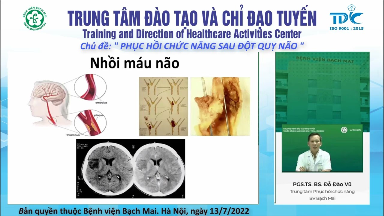 8.Phục hồi chức năng sau đột quỵ não
