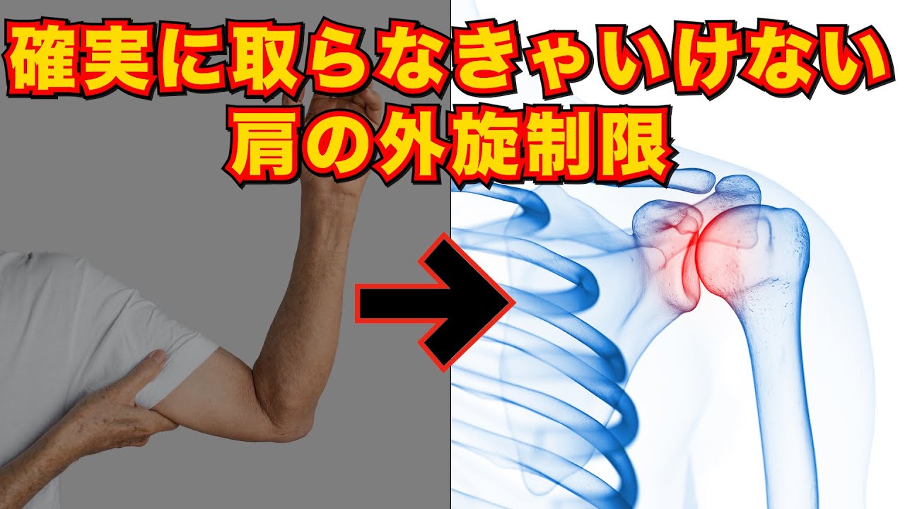 【拘縮肩治療Phase 1】　下垂位での外旋制限を解消しないと始まらない！#セミナー #セラピスト #リハビリ #神経痛 #リハビリ #解剖学 #柔道整復師 #治療