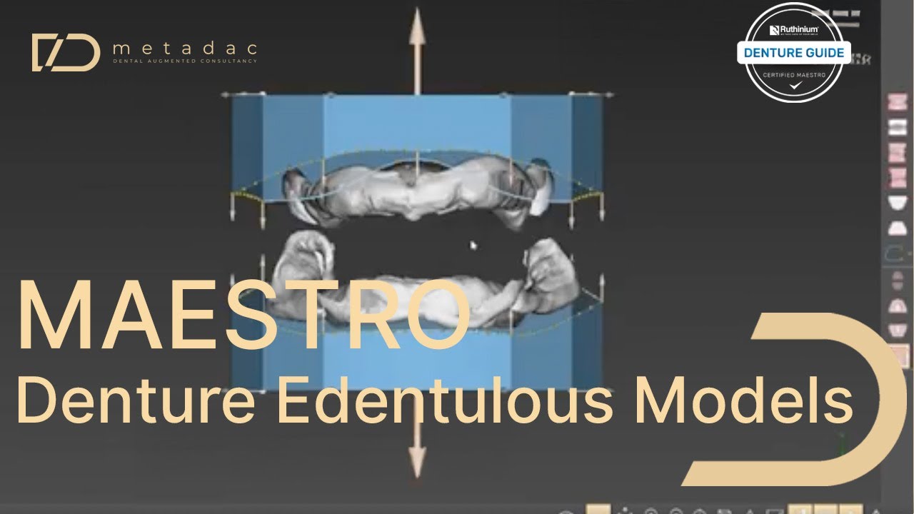 Digital Dentures: Edentulous models
