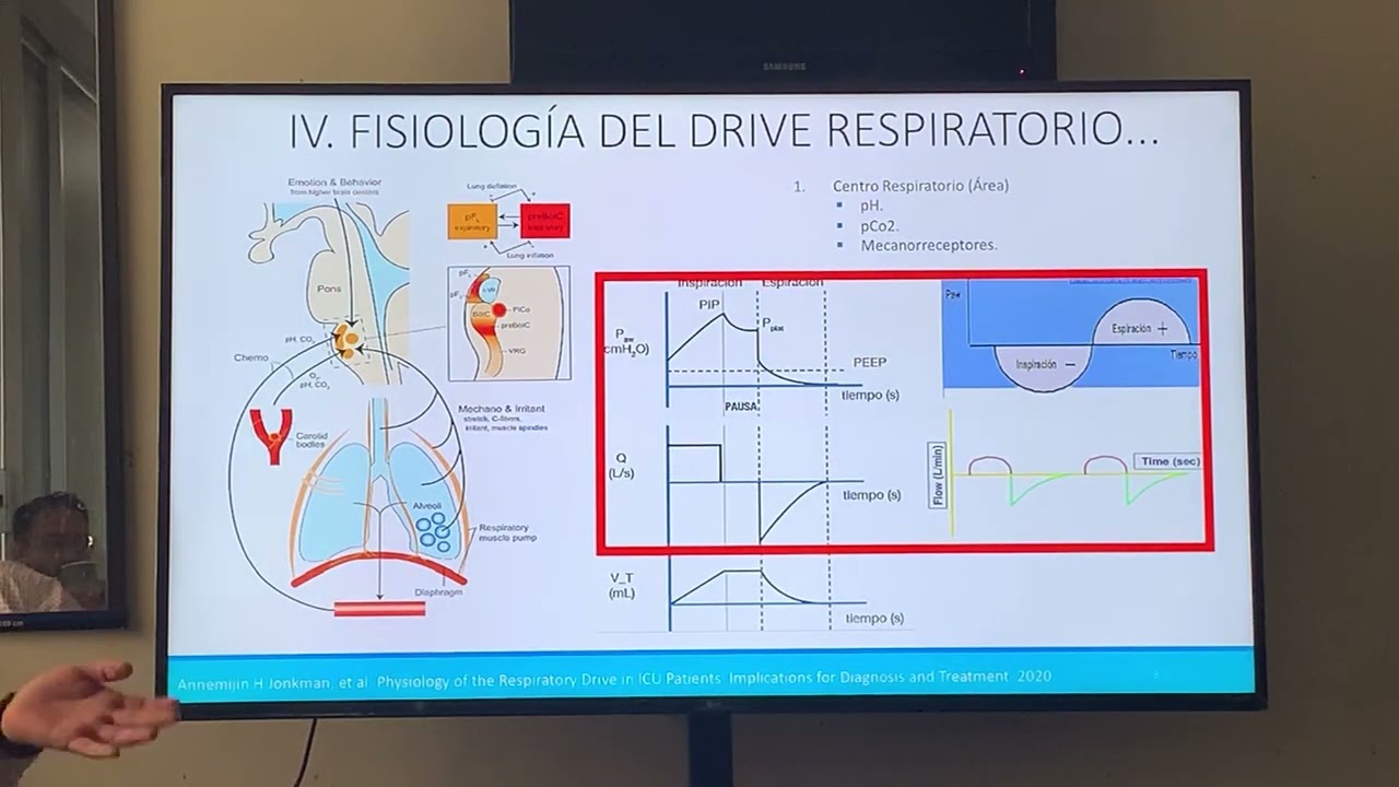 Asincronías en ventilación mecánica