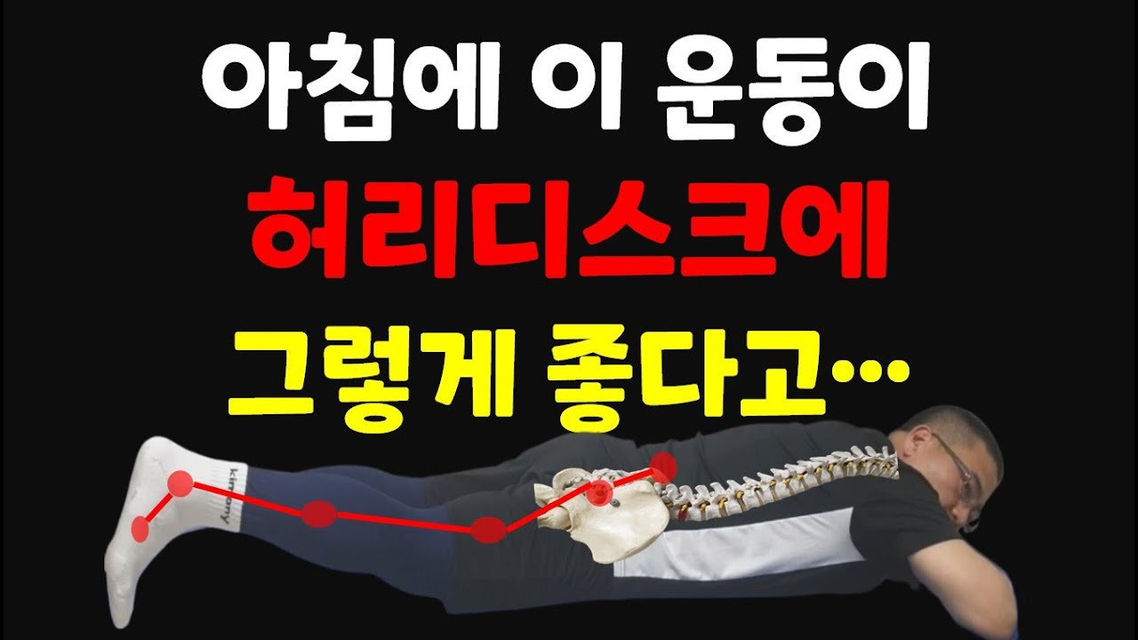 아침마다 했더니 허리디스크와 좌골신경통 거짓말처럼 사라지는 소름돋는 결과보장!!