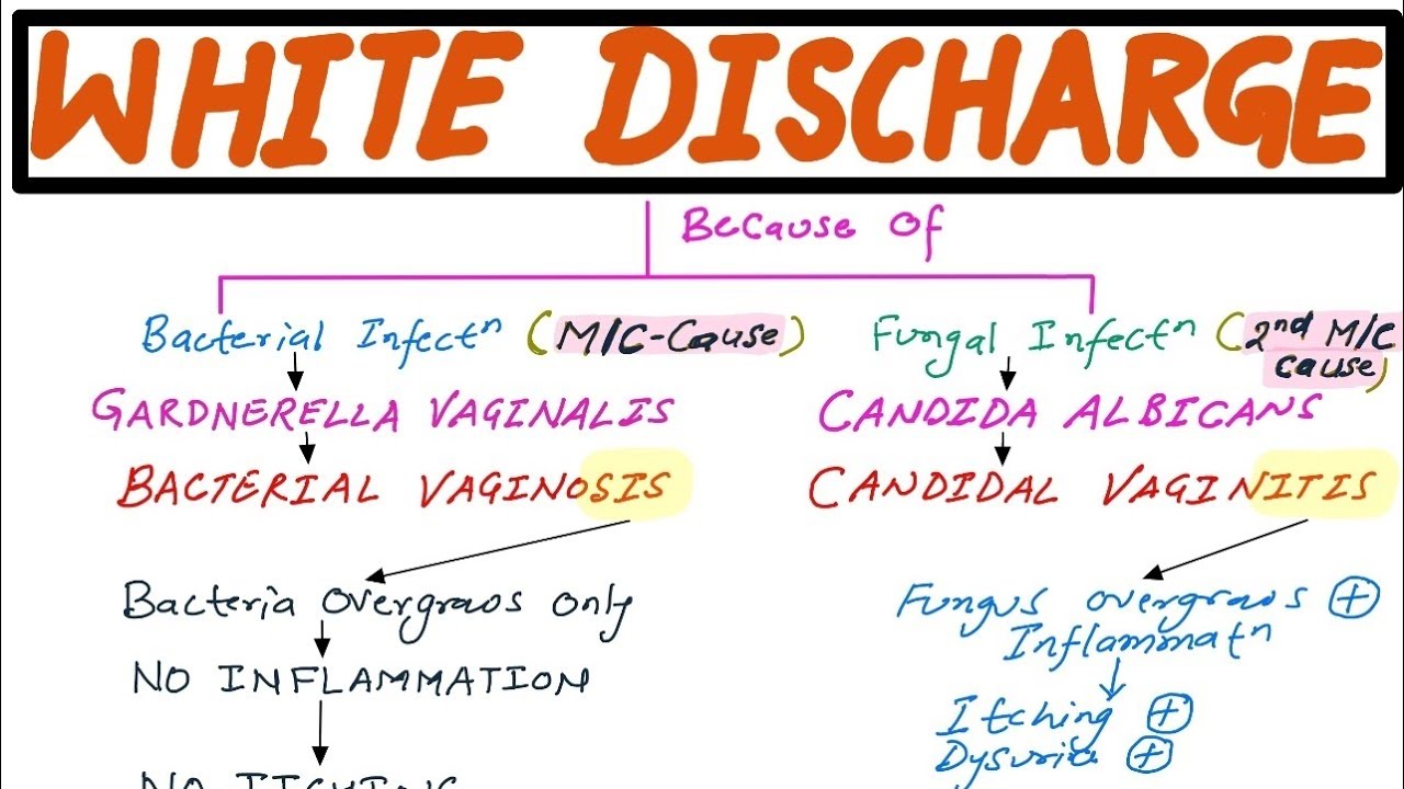 GYNECOLOGY LECTURE - White Discharge (Bacterial Vaginosis & Candidal Vaginitis)